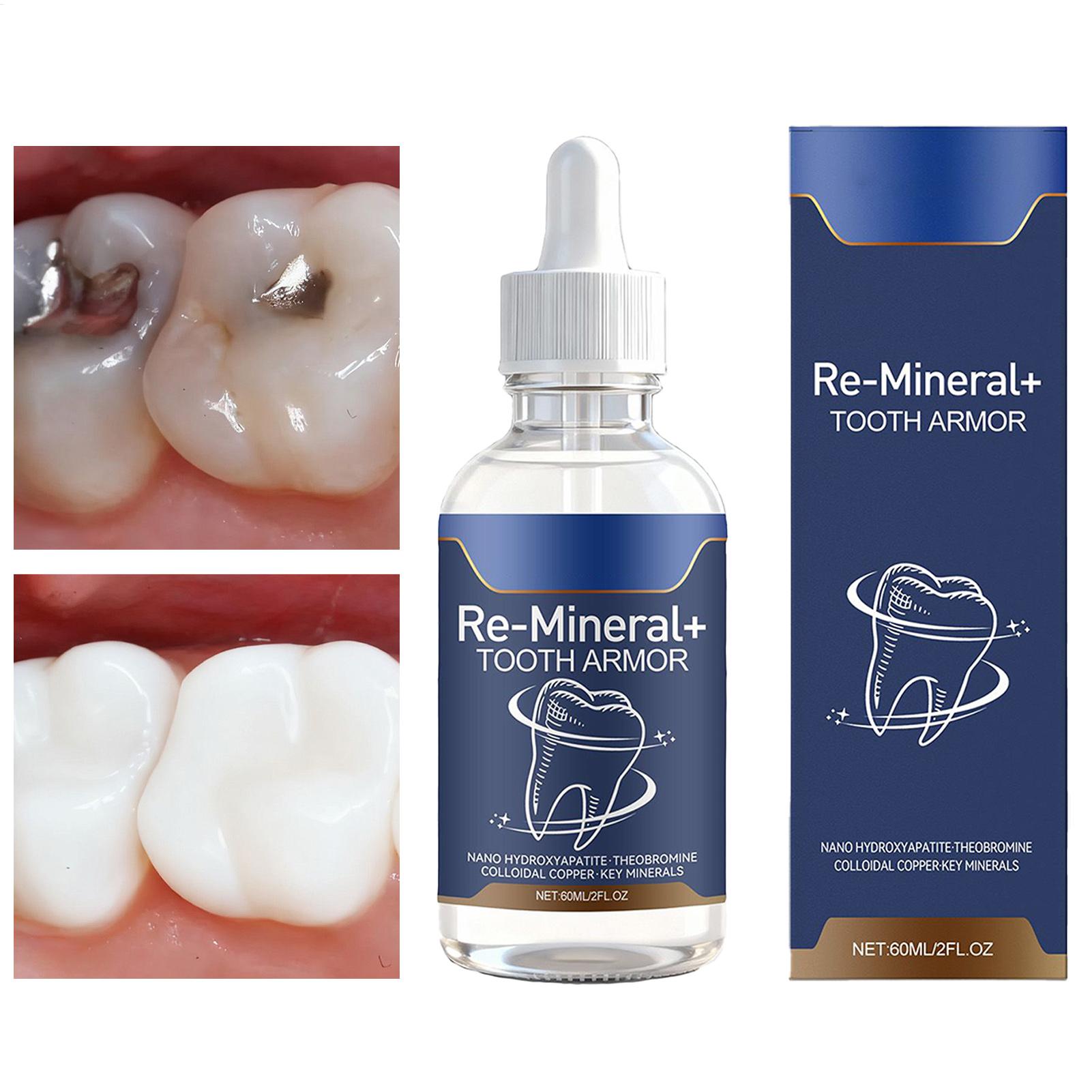 Teeth Whitening And Stain Removal - Cairan Pembersih Gigi 60Ml Menghilangkan Noda