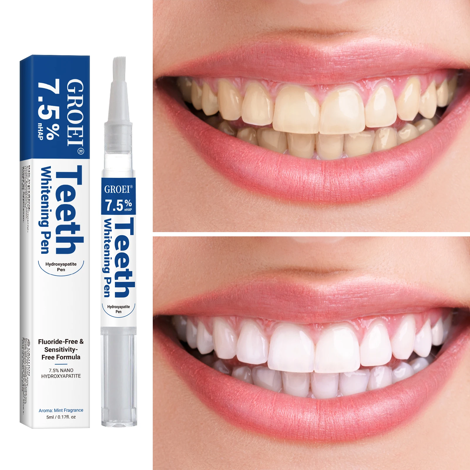 Pena Pemutih Gigi Hidroksiapat - Teeth Whitening Singapore ulasan dan harga