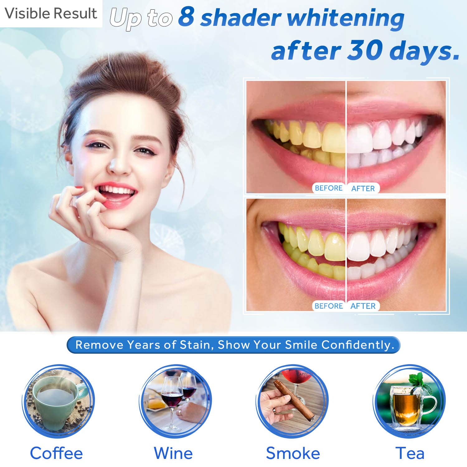 Gel Pemutih Gigi Isi Ulang Syr - Teeth Whitening Singapore ulasan dan harga
