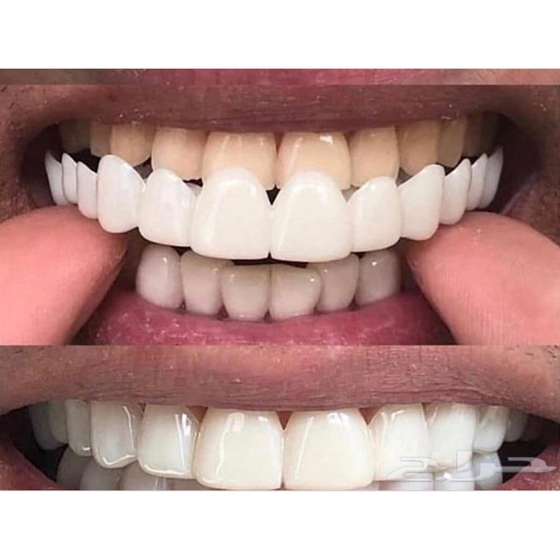 Silikon Lembut Gel Gigi Mulut  - Teeth Whitening Moulds ulasan dan harga