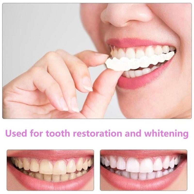 Veneer Gigi Snap On, Veneer Se - Teeth Whitening Instant ulasan dan harga