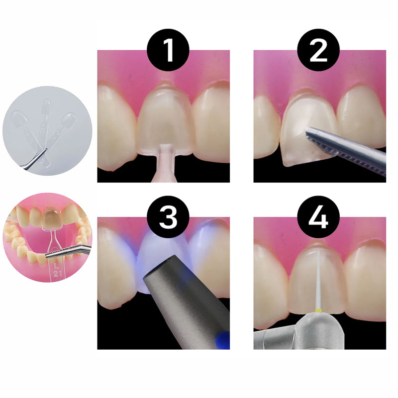 32pcs/Set Cetakan Resin Kompos - Teeth Whitening Moulds ulasan dan harga
