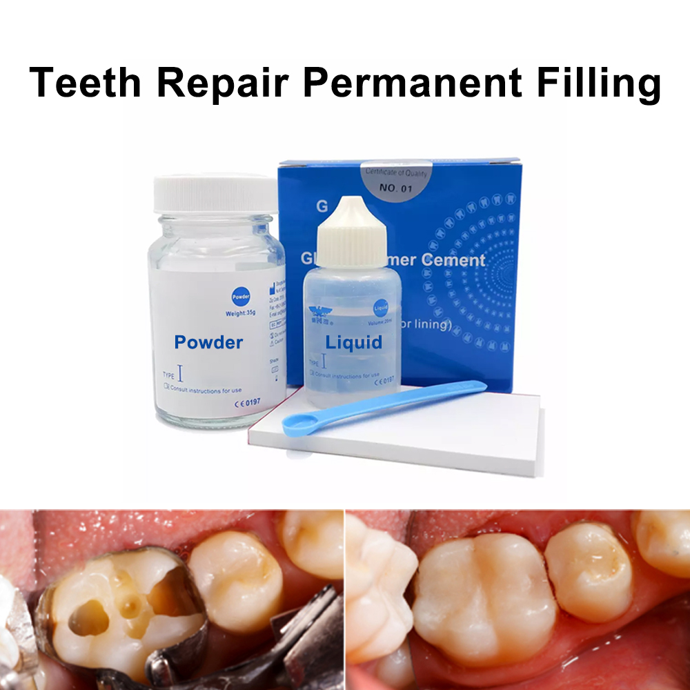 Kit Perbaikan Tambal Gigi Perm - Teeth Whitening Kit At Home ulasan dan harga