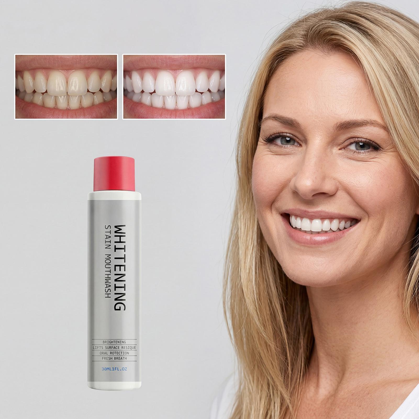 Obat Kumur Pemutih Noda 30ml M - Teeth Whitening And Stain Removal ulasan dan harga
