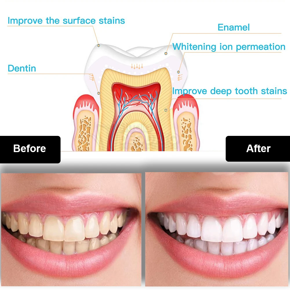 Kit pemutih gigi Mini 16 LED c - Teeth Whitening Singapore ulasan dan harga